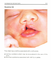 5- Pediatrics OSCE.pdf